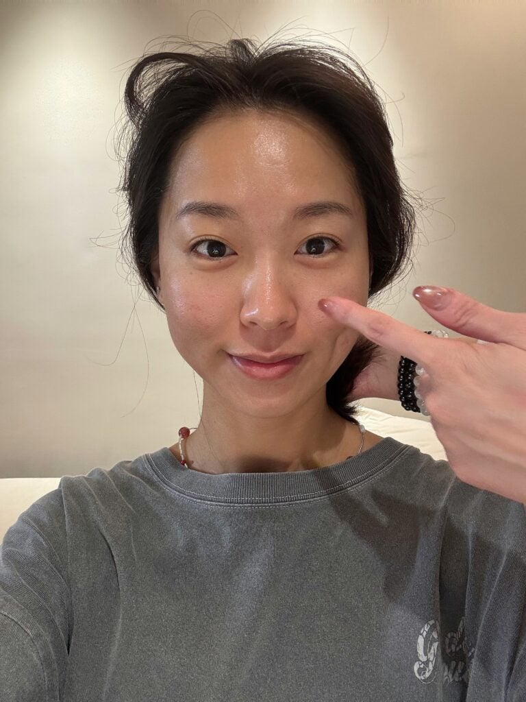 台北美顏針_太初中醫診所_2025-06-03_0