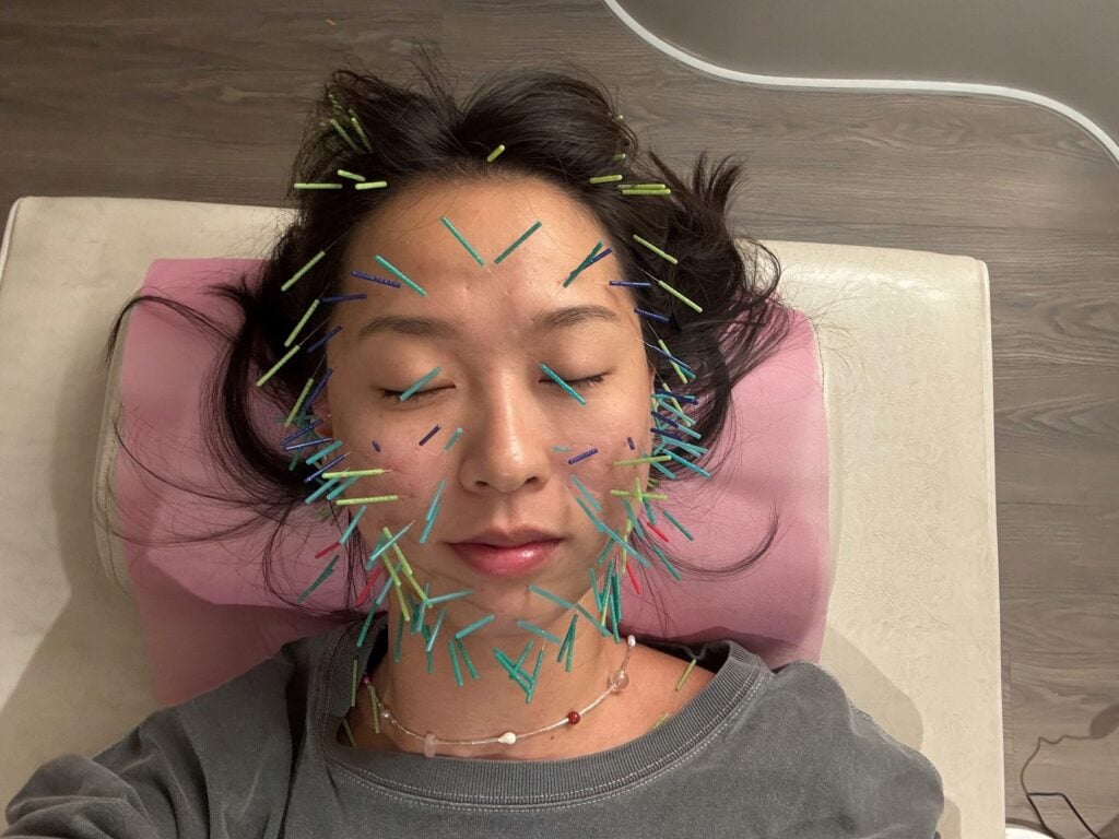台北美顏針_太初中醫診所_2025-06-03_1